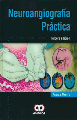 NEUROANGIOGRAFIA PRACTICA 3RA EDIC