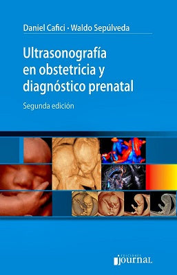 ULTRASONOGRAFIA EN OBSTETRICIA Y DIAGNOSTICO PRENATAL 2DA.